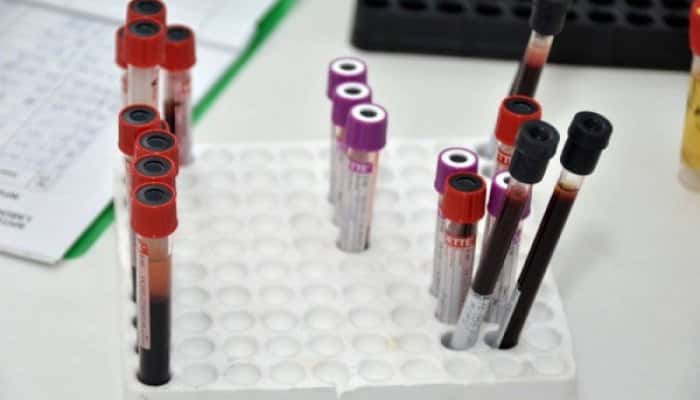 Ministerul Sănătății a confirmat primul caz de coronavirus în România. Încă o probă este în lucru