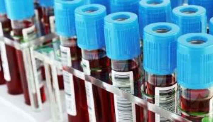 CORONAVIRUS | A fost confirmat al șaptelea caz pe teritoriul României