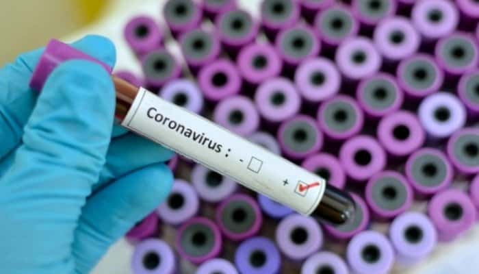 CORONAVIRUS | Mediul privat se mobilizează. Kaufland și Lidl România donează 100.000 recoltoare pentru testele Covid-19, OMV Petrom a oferit un milion de euro pntru echipamente de testare