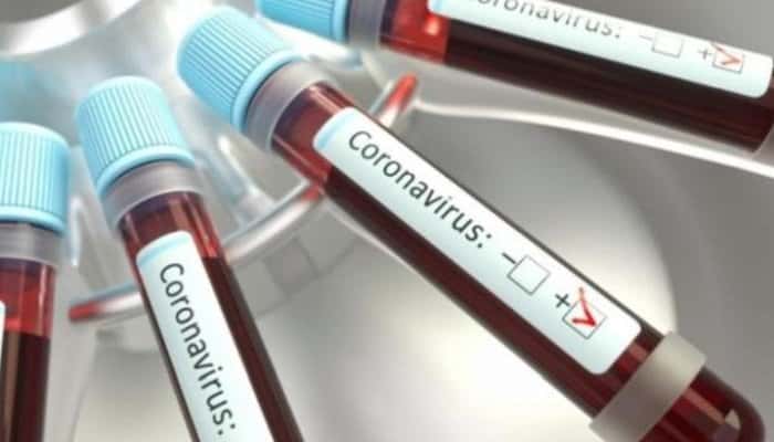 CORONAVIRUS | Trei noi decese confirmate marți seară, în România. Numărul persoanelor infectate se apropie de 800