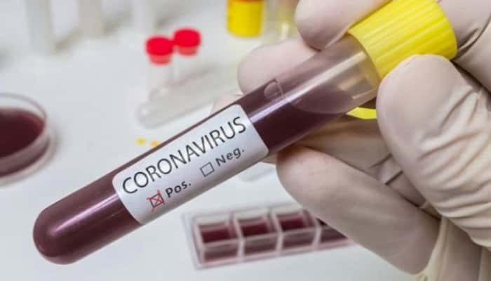 CORONAVIRUS | România a atins pragul de 400 de decese. Un bărbat de 41 de ani, din Ialomița, fără antecedente patologice cunoscute, s-a stins din viață joi