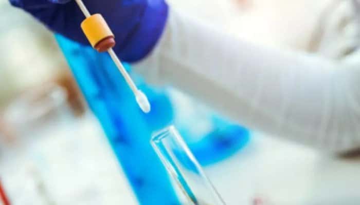 CORONAVIRUS PRAHOVA. 47 persoane declarate vindecate și externate. Trei persoane în stare gravă la Spitalul Județean de Urgență Ploiești