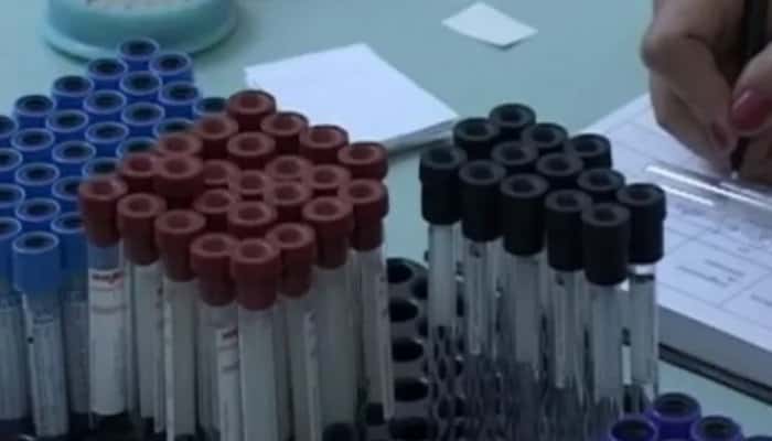 CORONAVIRUS PRAHOVA | Noi cazuri confirmate în județ, în ultimele 24 de ore