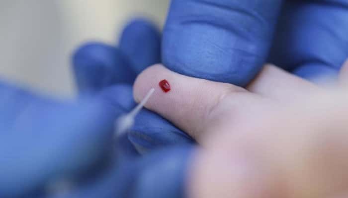 Coronavirus. Diabeticii de tip 2, de peste 75 de ani, mai predispuşi la o formă gravă de COVID-19