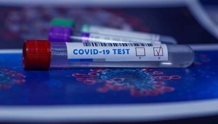 CORONAVIRUS | A început testarea în masă. Când vom afla rezultatele