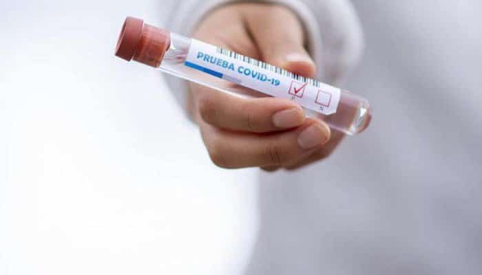 Turcia renunţă parţial la obligativitatea testelor PCR pentru nevaccinaţi