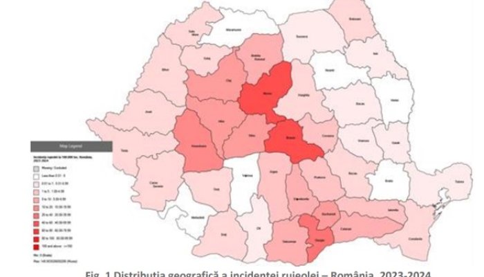 evoluție epidemie rujeolă